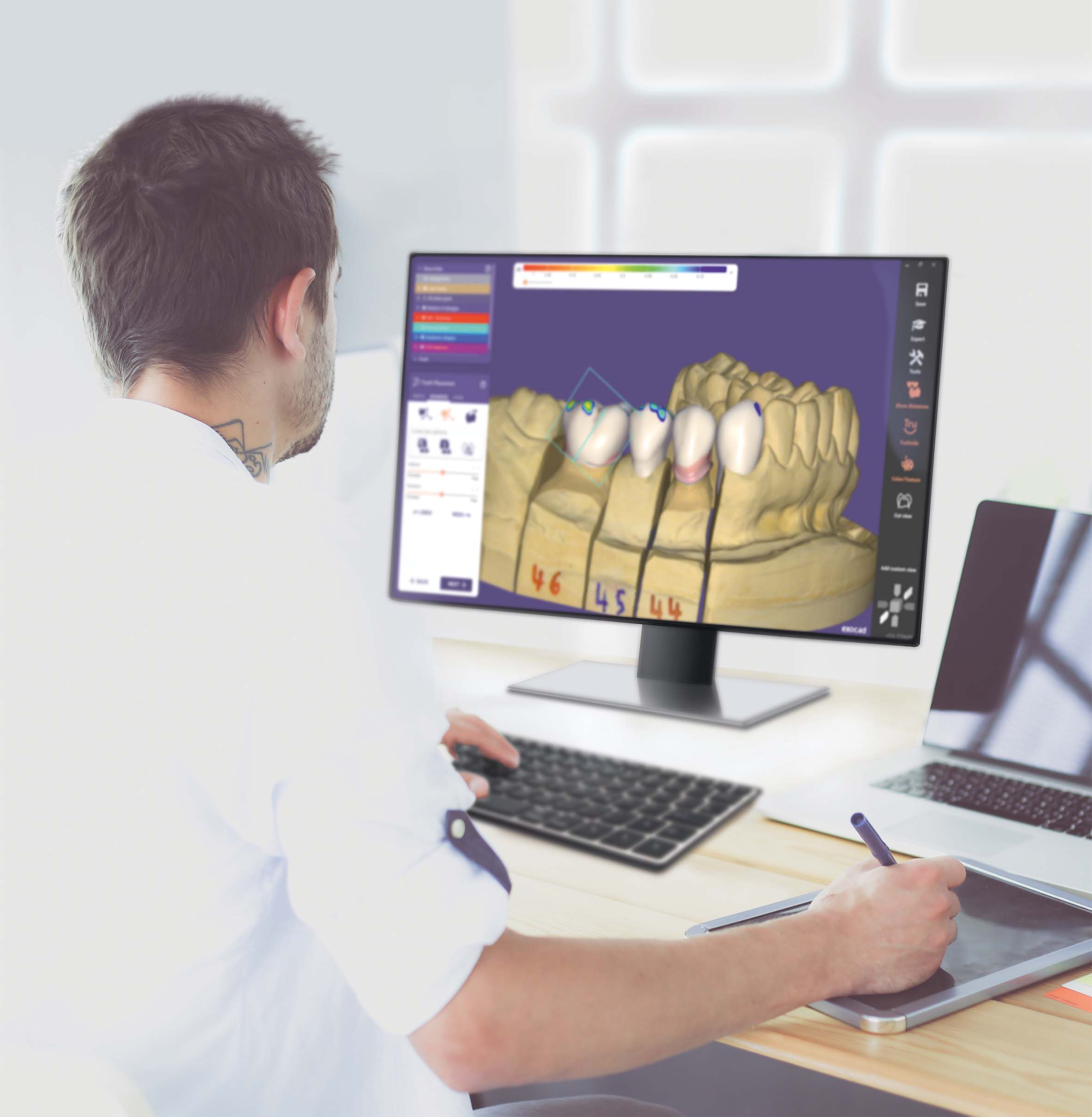exocad_DentalCAD_Galway_Page_4_Instant_Anatomic_Morphing